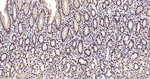 hnRNP K Antibody in Immunohistochemistry (Paraffin) (IHC (P))