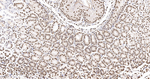 hnRNP K Antibody in Immunohistochemistry (Paraffin) (IHC (P))
