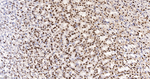 hnRNP K Antibody in Immunohistochemistry (Paraffin) (IHC (P))