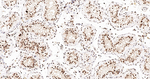 hnRNP K Antibody in Immunohistochemistry (Paraffin) (IHC (P))