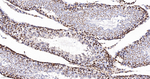 hnRNP K Antibody in Immunohistochemistry (Paraffin) (IHC (P))