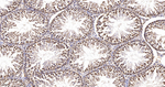 hnRNP K Antibody in Immunohistochemistry (Paraffin) (IHC (P))