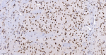 hnRNP K Antibody in Immunohistochemistry (Paraffin) (IHC (P))