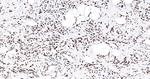 hnRNP K Antibody in Immunohistochemistry (Paraffin) (IHC (P))
