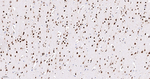 hnRNP K Antibody in Immunohistochemistry (Paraffin) (IHC (P))