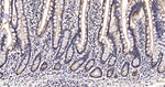 hnRNP K Antibody in Immunohistochemistry (Paraffin) (IHC (P))