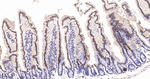 hnRNP K Antibody in Immunohistochemistry (Paraffin) (IHC (P))