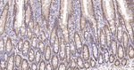 hnRNP K Antibody in Immunohistochemistry (Paraffin) (IHC (P))