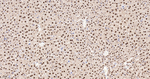 hnRNP K Antibody in Immunohistochemistry (Paraffin) (IHC (P))