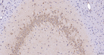 eIF5A Antibody in Immunohistochemistry (Paraffin) (IHC (P))