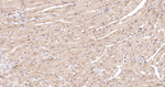 eIF5A Antibody in Immunohistochemistry (Paraffin) (IHC (P))