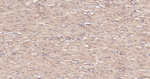 eIF5A Antibody in Immunohistochemistry (Paraffin) (IHC (P))