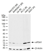 eIF5A Antibody in Western Blot (WB)