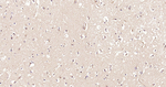 SCF Antibody in Immunohistochemistry (Paraffin) (IHC (P))