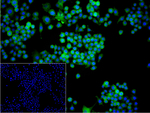 Cortactin Recombinant Rabbit Monoclonal Antibody (7E5)