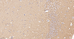 Cortactin Antibody in Immunohistochemistry (Paraffin) (IHC (P))