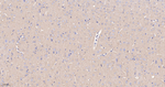 Cortactin Antibody in Immunohistochemistry (Paraffin) (IHC (P))