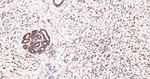 Cortactin Antibody in Immunohistochemistry (Paraffin) (IHC (P))