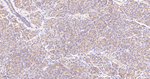 Cortactin Antibody in Immunohistochemistry (Paraffin) (IHC (P))
