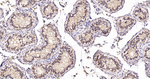 Cortactin Antibody in Immunohistochemistry (Paraffin) (IHC (P))