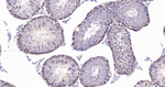 Cortactin Antibody in Immunohistochemistry (Paraffin) (IHC (P))