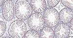 Cortactin Antibody in Immunohistochemistry (Paraffin) (IHC (P))