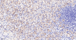 Catenin alpha-1 Recombinant Rabbit Monoclonal Antibody (12F9)