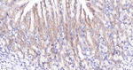 Catenin alpha-1 Antibody in Immunohistochemistry (Paraffin) (IHC (P))