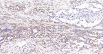 Radixin Recombinant Rabbit Monoclonal Antibody (5E2)