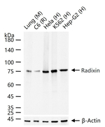 Radixin Antibody in Western Blot (WB)