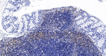 LSP1 Antibody in Immunohistochemistry (Paraffin) (IHC (P))