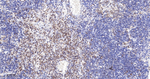 LSP1 Antibody in Immunohistochemistry (Paraffin) (IHC (P))