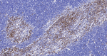 LSP1 Antibody in Immunohistochemistry (Paraffin) (IHC (P))