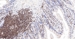 LSP1 Antibody in Immunohistochemistry (Paraffin) (IHC (P))