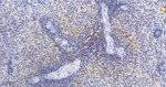 LSP1 Antibody in Immunohistochemistry (Paraffin) (IHC (P))