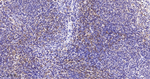 LSP1 Antibody in Immunohistochemistry (Paraffin) (IHC (P))