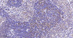 LSP1 Antibody in Immunohistochemistry (Paraffin) (IHC (P))