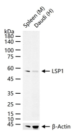 LSP1 Antibody in Western Blot (WB)