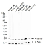 ATP5G1 Recombinant Rabbit Monoclonal Antibody (4D12)