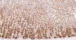 RALBP1 Antibody in Immunohistochemistry (Paraffin) (IHC (P))
