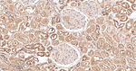 RALBP1 Antibody in Immunohistochemistry (Paraffin) (IHC (P))