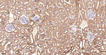 RALBP1 Antibody in Immunohistochemistry (Paraffin) (IHC (P))