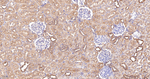 RALBP1 Antibody in Immunohistochemistry (Paraffin) (IHC (P))