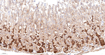 RALBP1 Antibody in Immunohistochemistry (Paraffin) (IHC (P))