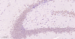 hnRNP C1/C2 Recombinant Rabbit Monoclonal Antibody (19B3)