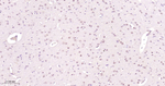 hnRNP C1/C2 Antibody in Immunohistochemistry (Paraffin) (IHC (P))