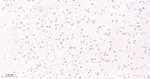 hnRNP C1/C2 Antibody in Immunohistochemistry (Paraffin) (IHC (P))