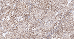 PRP19 Antibody in Immunohistochemistry (Paraffin) (IHC (P))