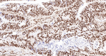 PRP19 Antibody in Immunohistochemistry (Paraffin) (IHC (P))