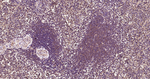 MyD88 Antibody in Immunohistochemistry (Paraffin) (IHC (P))